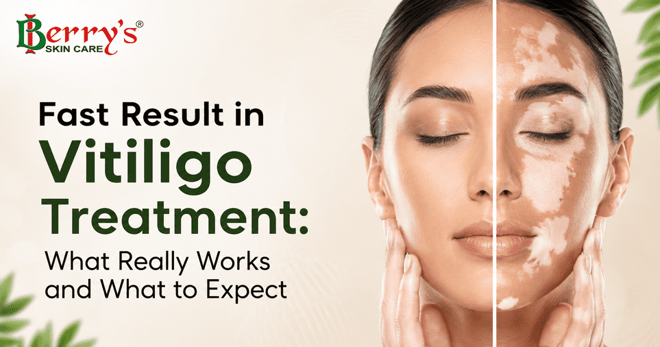 Fast Result in Vitiligo Treatment: What Really Works and What to Expect